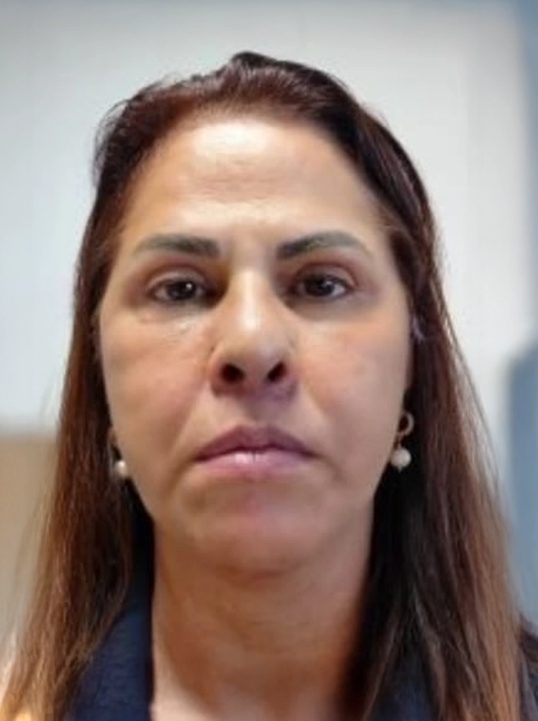 face depois1 face depois1
